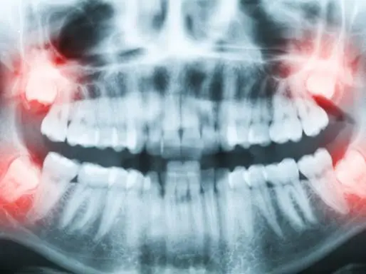 Markham Dental - General and Cosmetic Dentistry