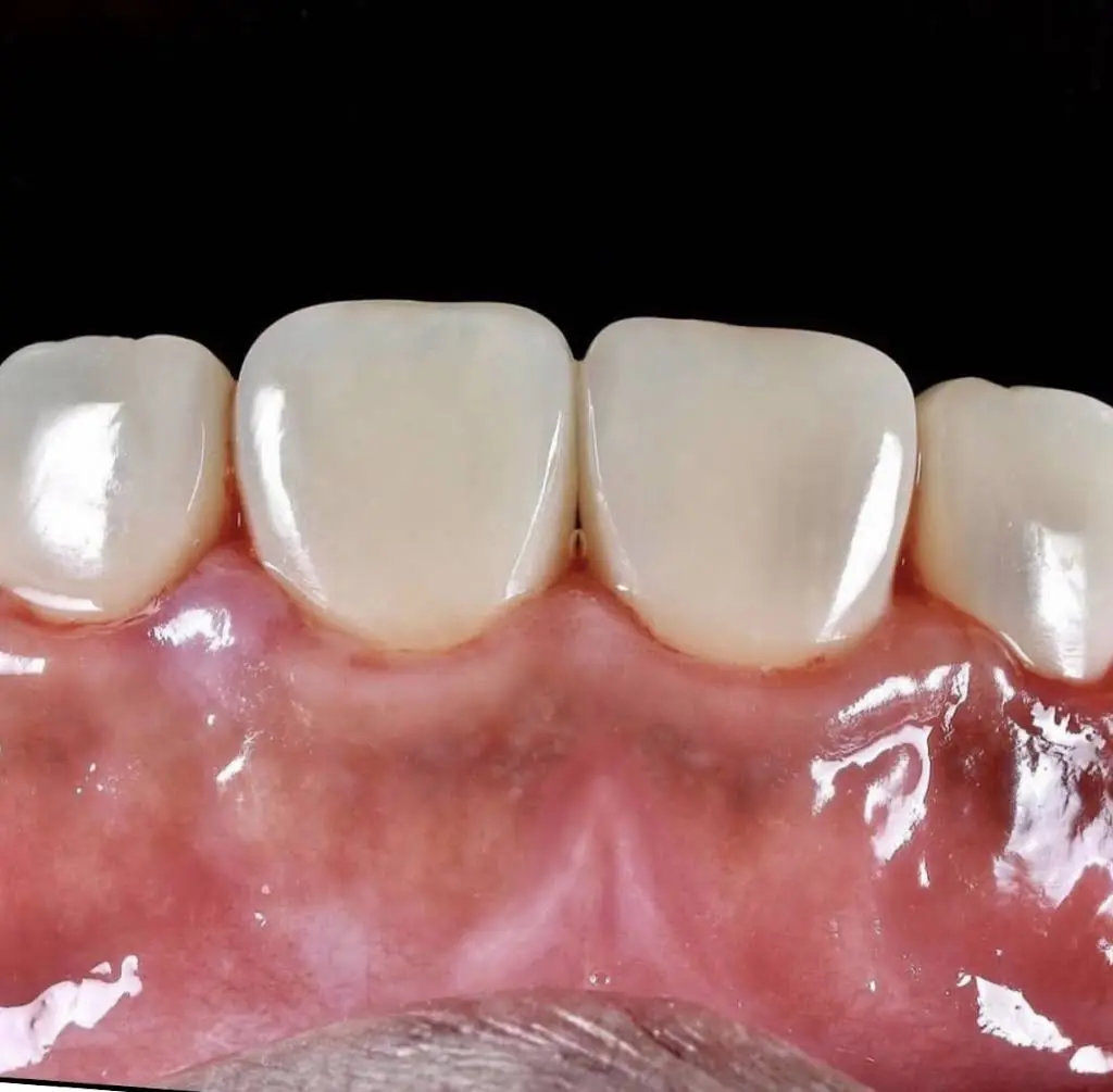 Walk In Dental Clinic on Yonge