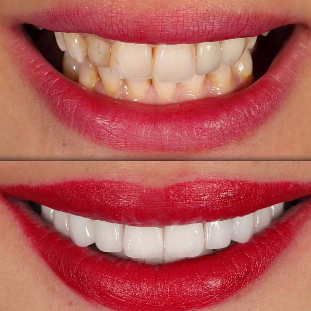 Walk In Dental Clinic on Yonge