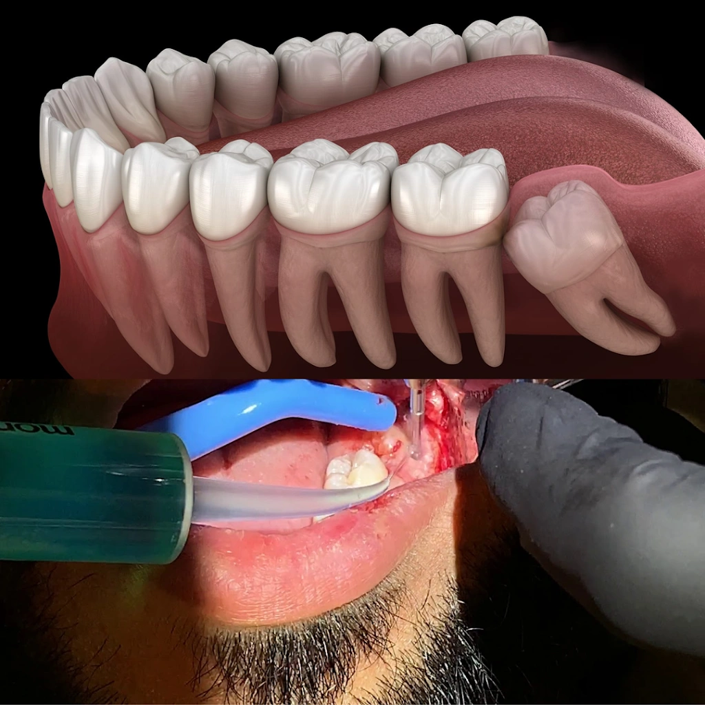 Walk In Dental Clinic on Yonge