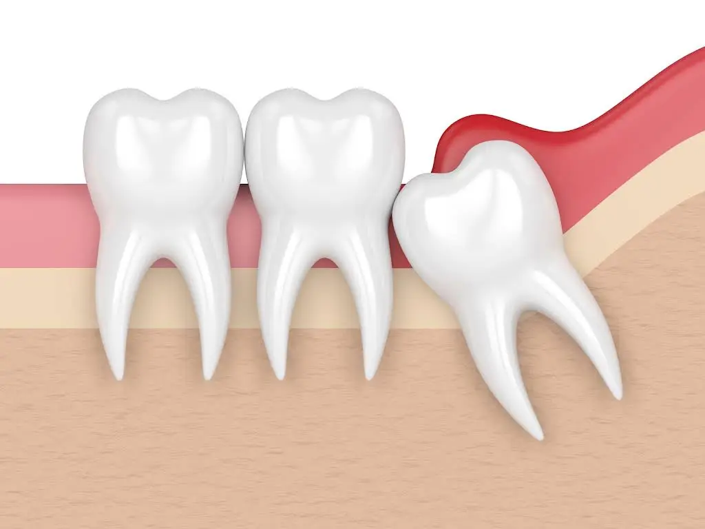 Walk In Dental Clinic on Yonge