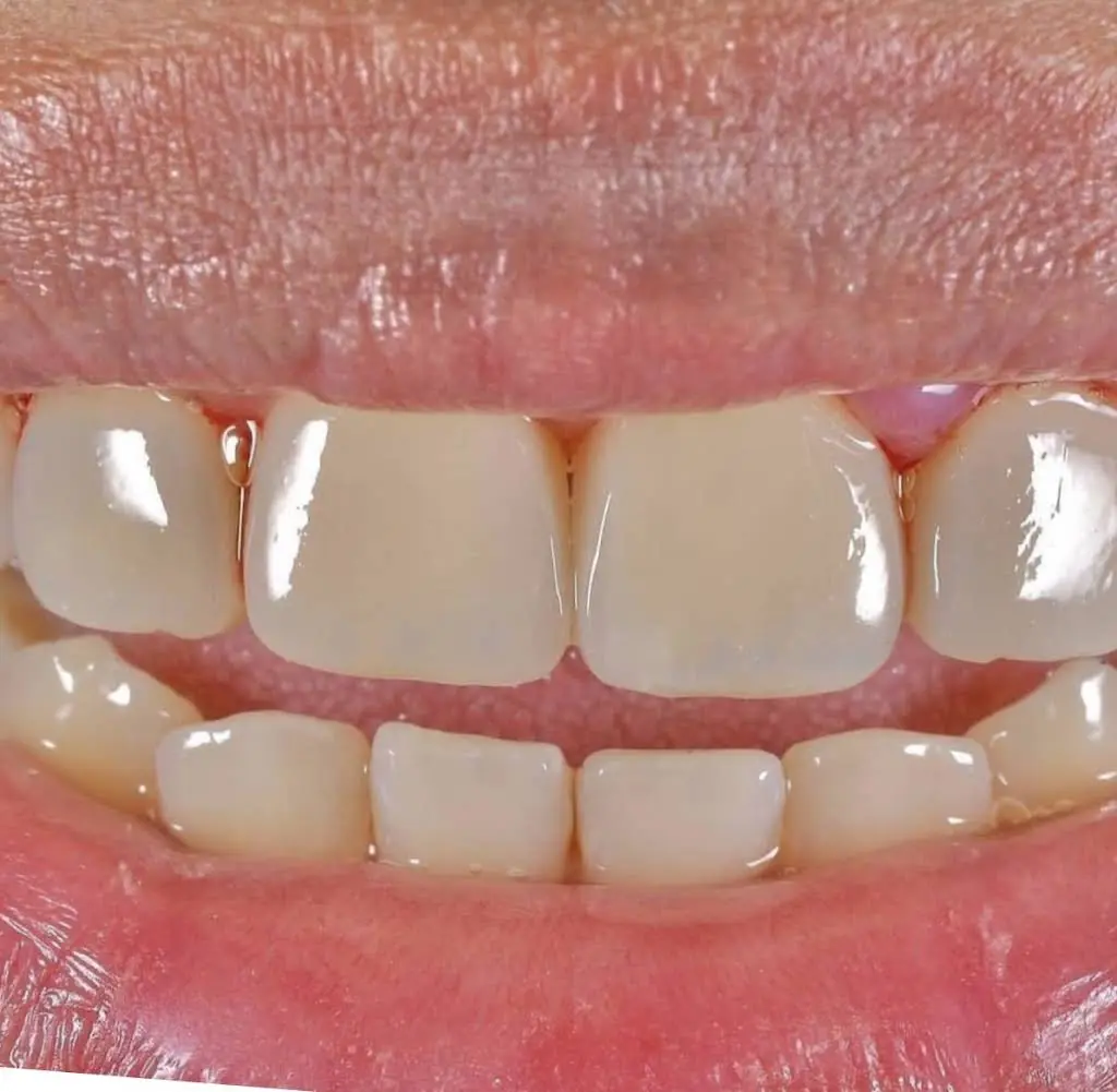 Walk In Dental Clinic on Yonge