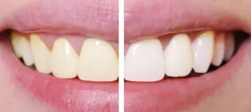 Montgomery Dental Care