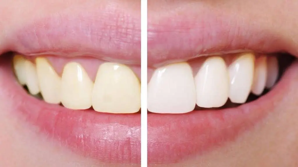 Montgomery Dental Care
