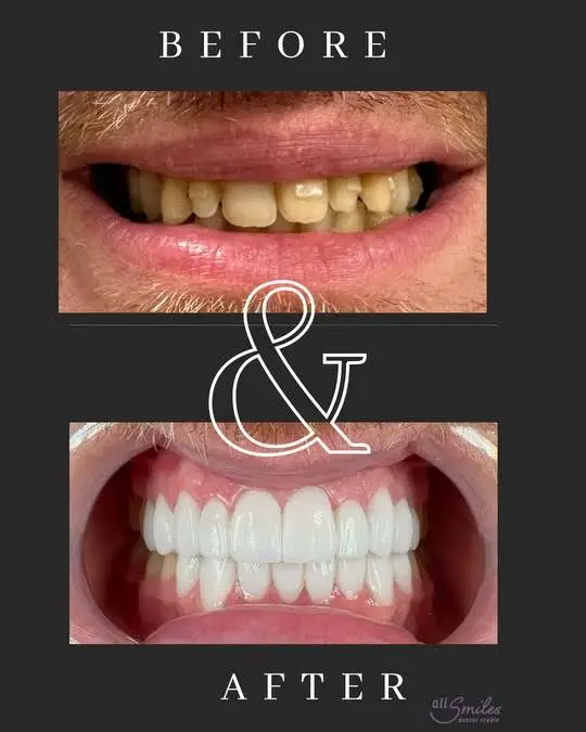 All Smiles Dental Studio of Eastgate
