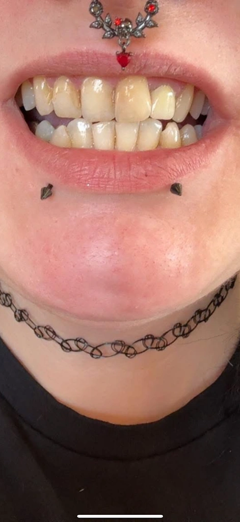 Bright Now! Dental & Orthodontics