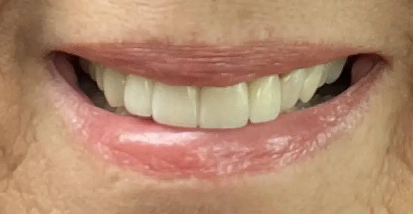 Strongsville Center for Cosmetic & Implant Dentistry