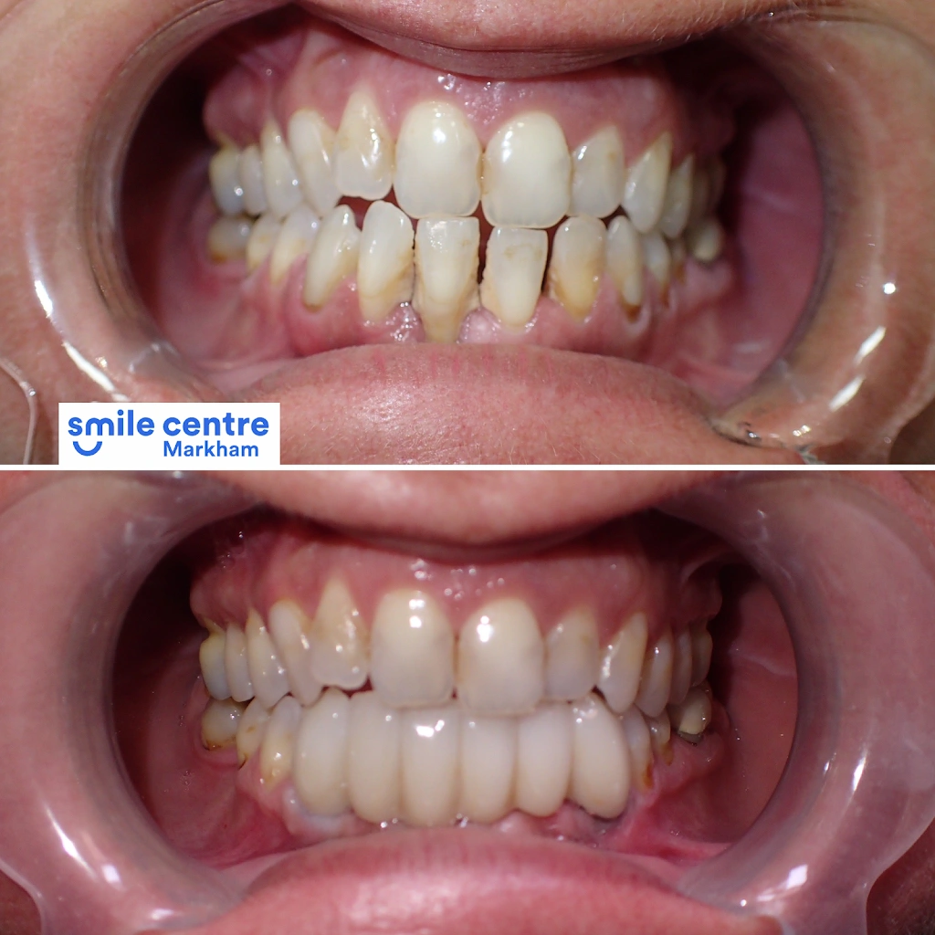 Markham Smile Centre