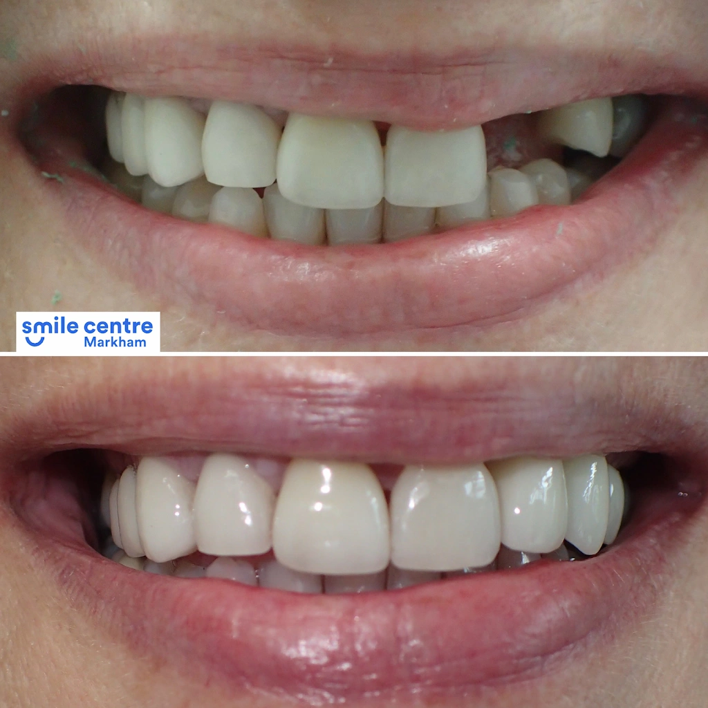 Markham Smile Centre