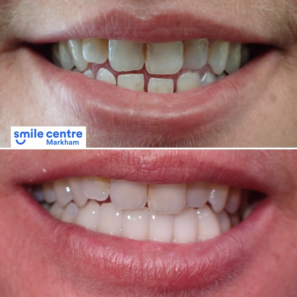 Markham Smile Centre