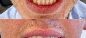 Markhamack Dental