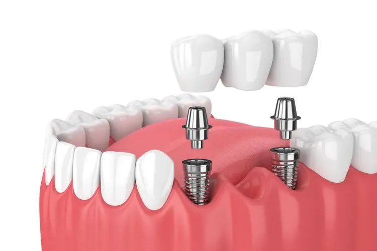 Markhamack Dental