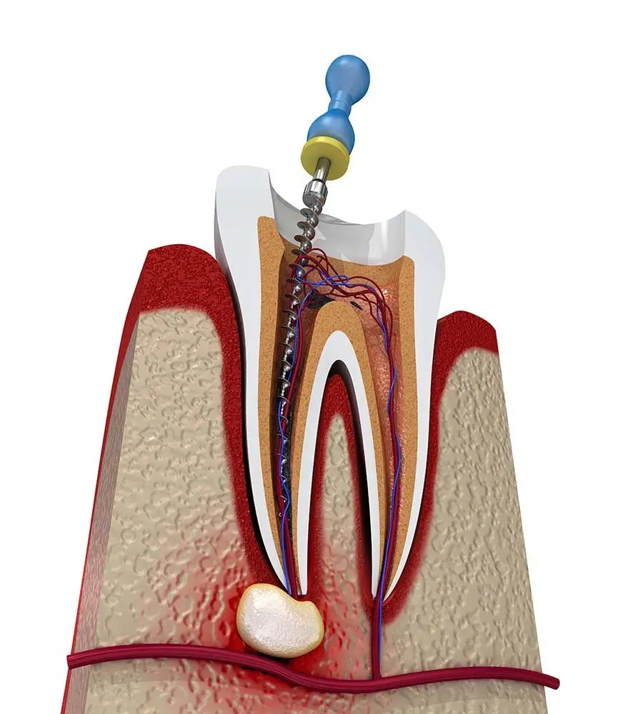 Markhamack Dental