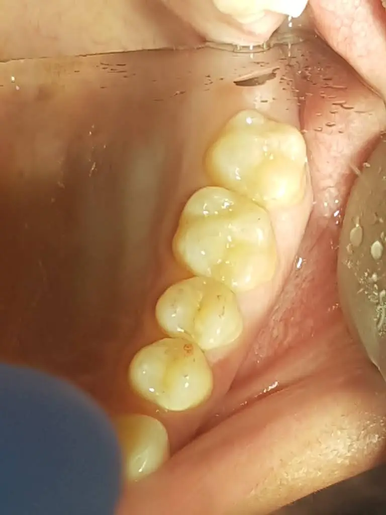 Clove Dental