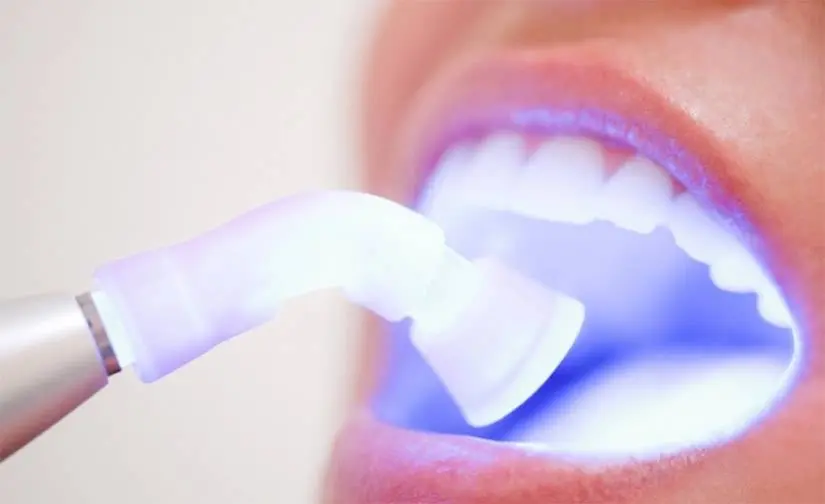Smiles Dentistry