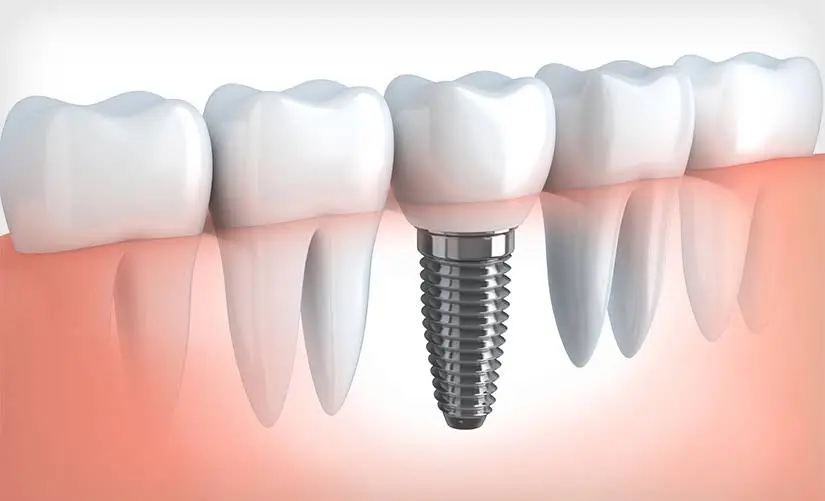 Smiles Dentistry