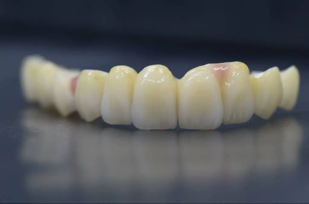 ALBLOOR DENTAL