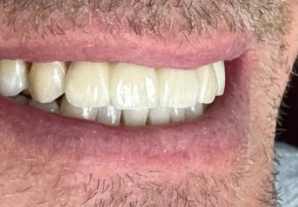 ALBLOOR DENTAL