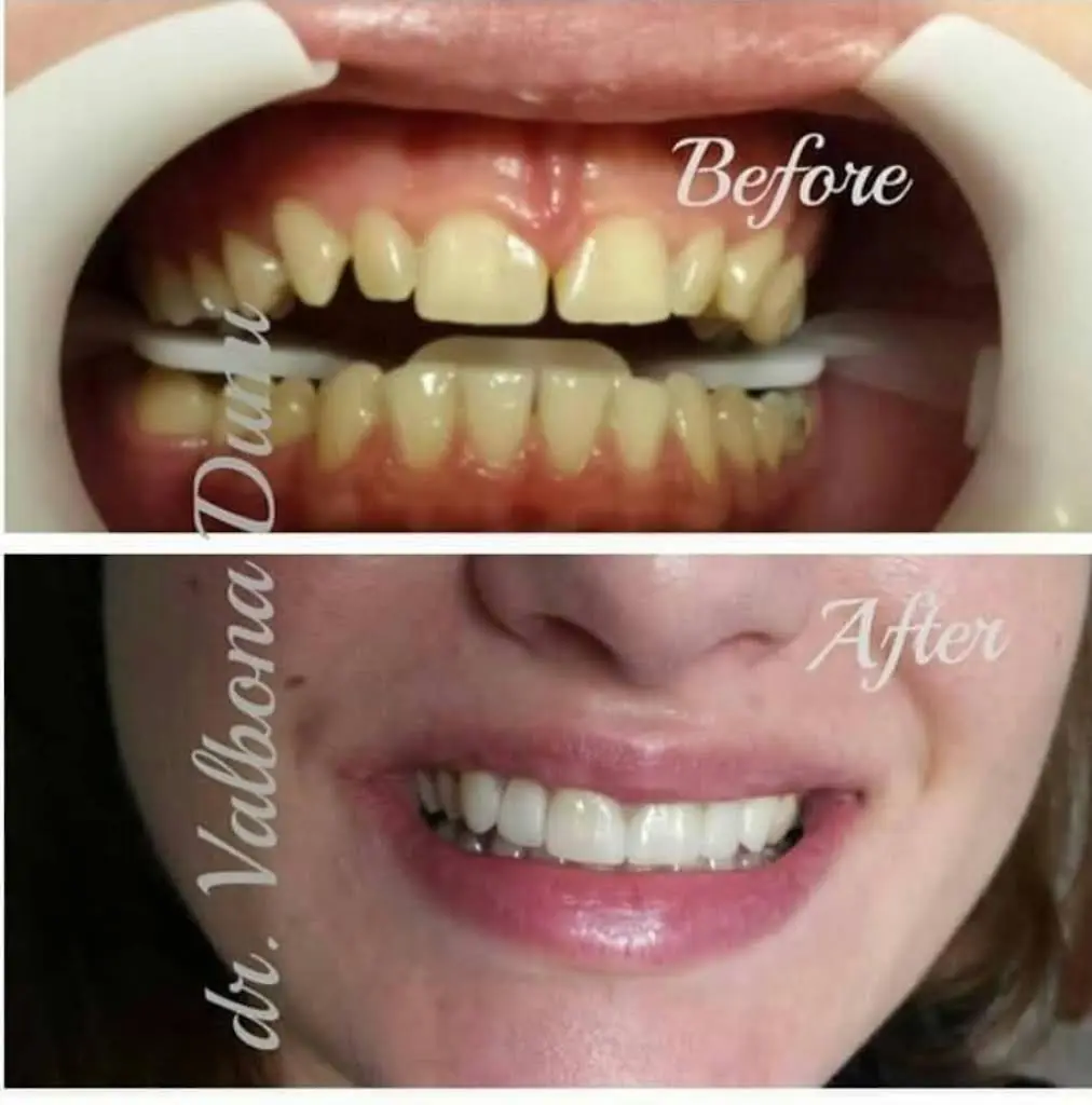 ALBLOOR DENTAL