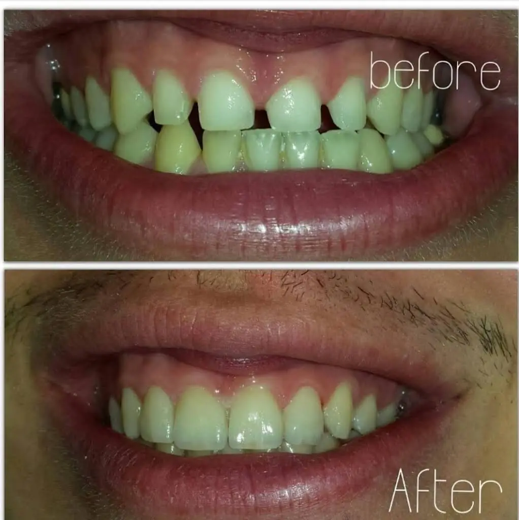 ALBLOOR DENTAL