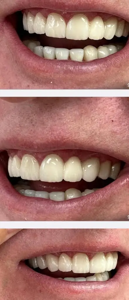 ALBLOOR DENTAL