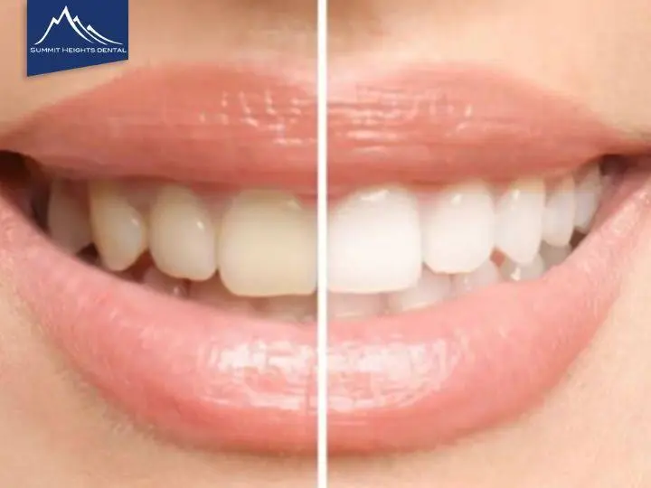 Summit Heights Dental