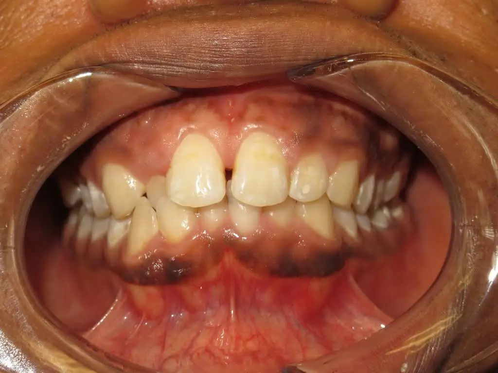 Waterdown Smiles Dentistry