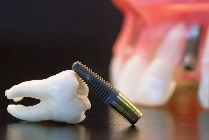 Periodontal & Implant Associates