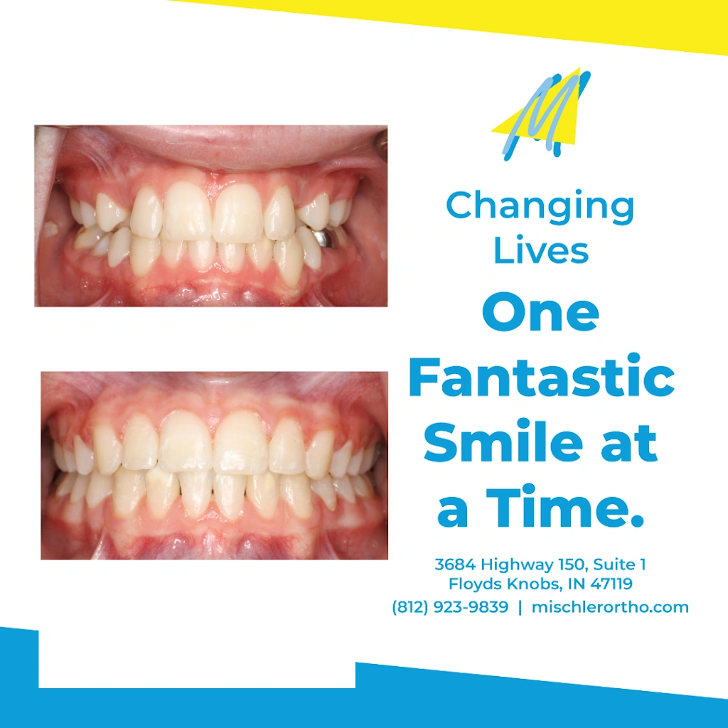 Mischler Orthodontics