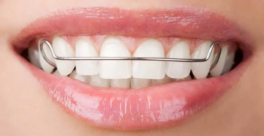 Ernstberger Orthodontics