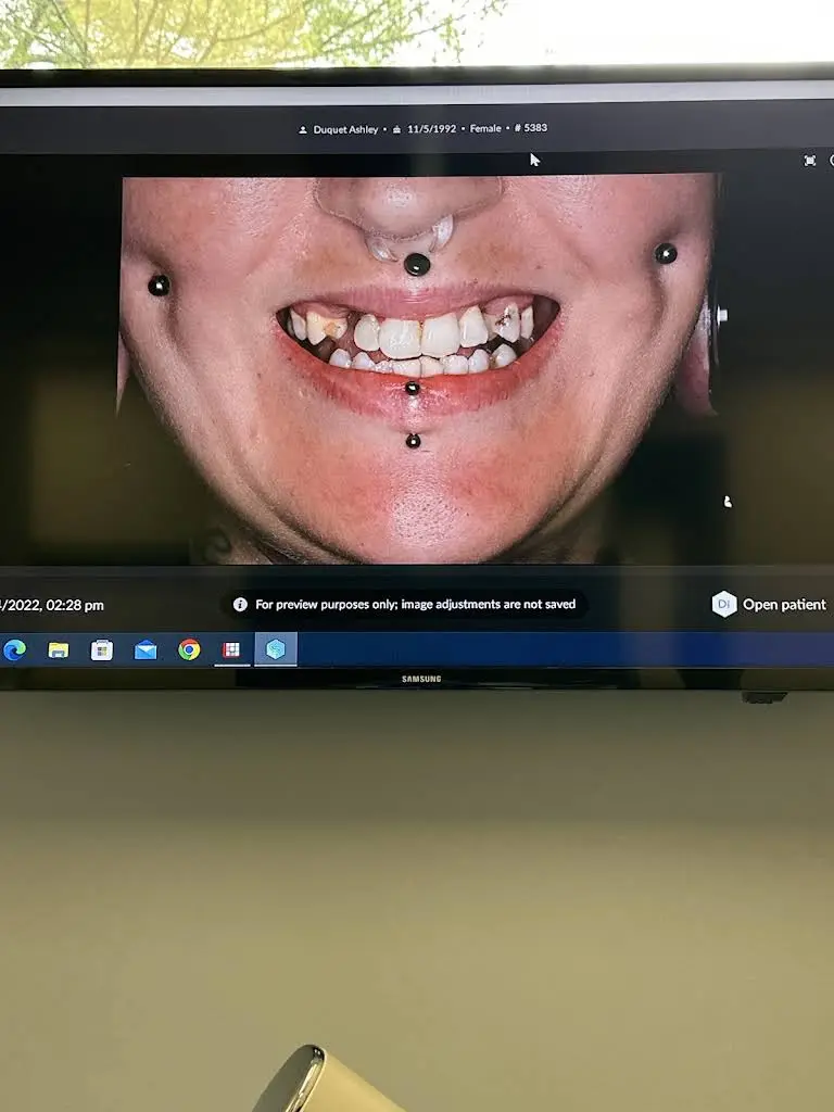 Embrace Dental Implant & General Dentistry