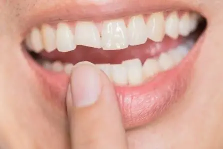 Louisville Dental E.R. | Urgent Dental Care