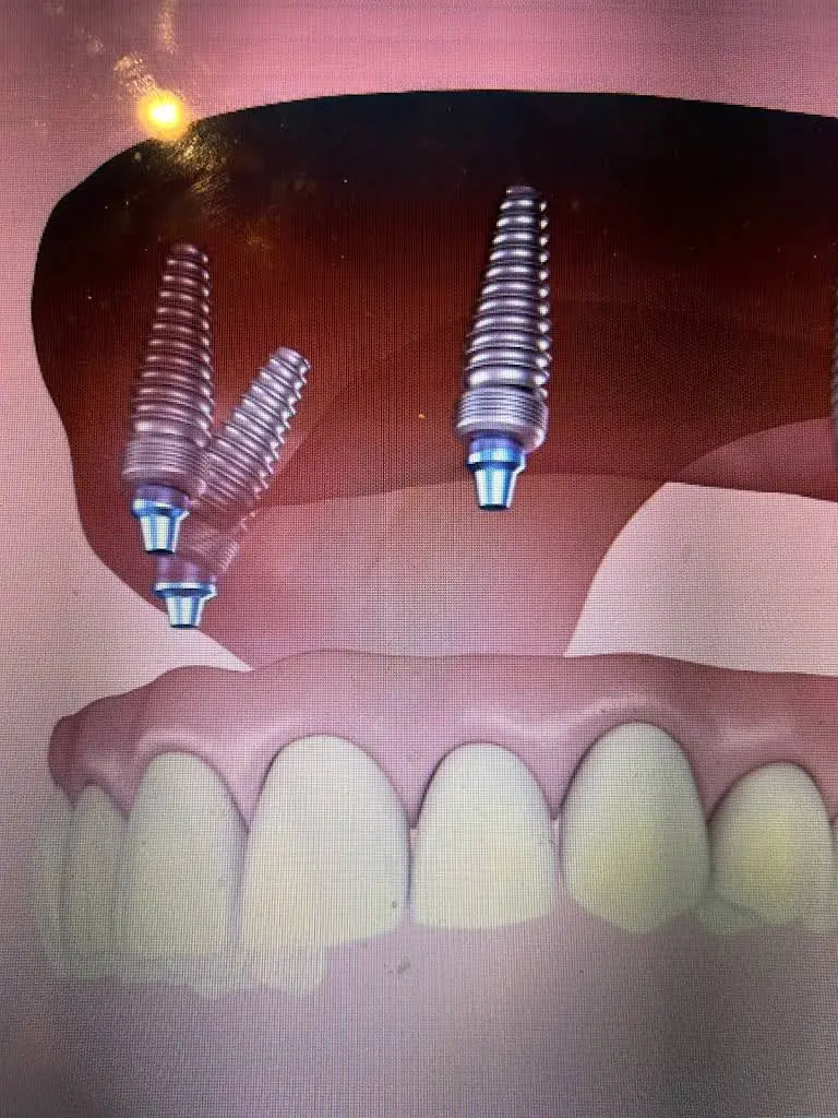 Walker Oral Surgery