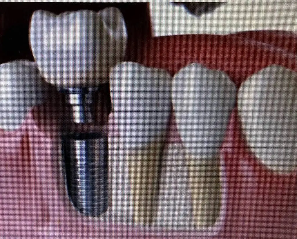 Walker Oral Surgery