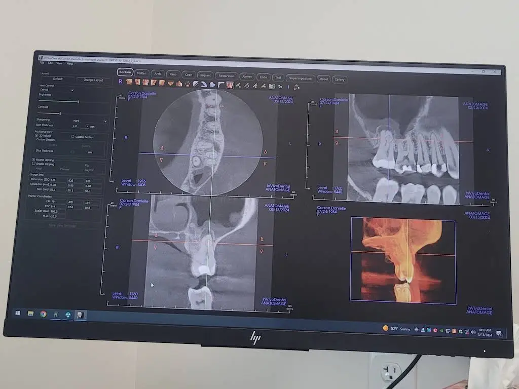 New Albany Endodontics