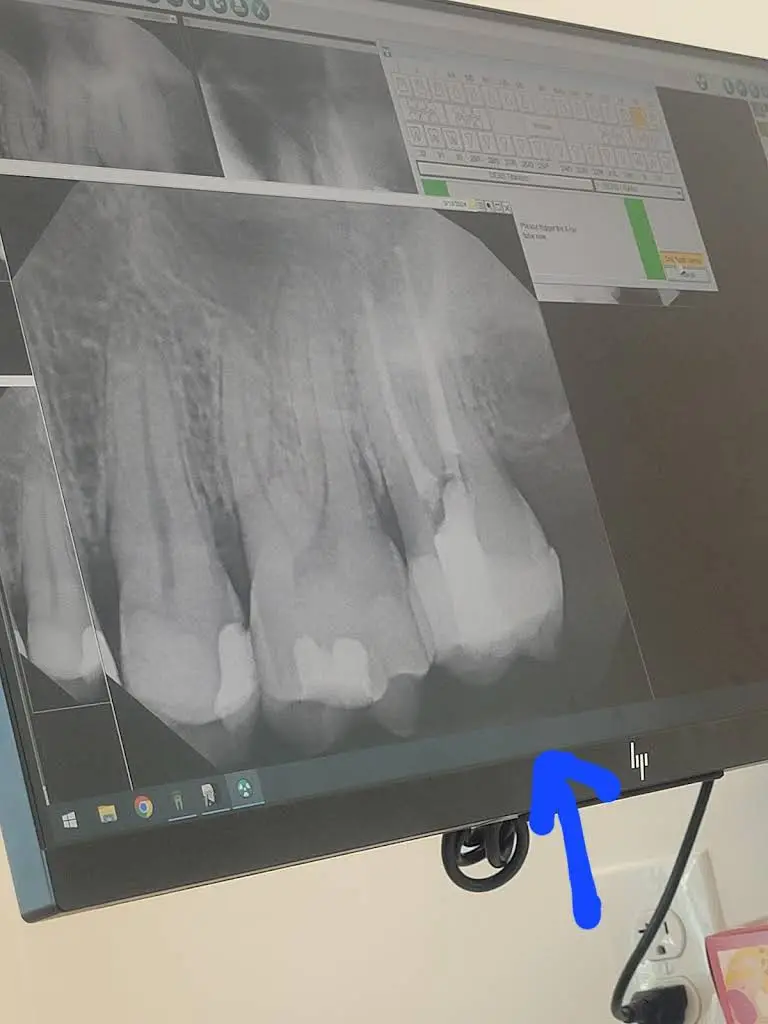 New Albany Endodontics