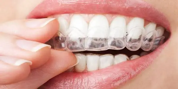 Precision Orthodontics