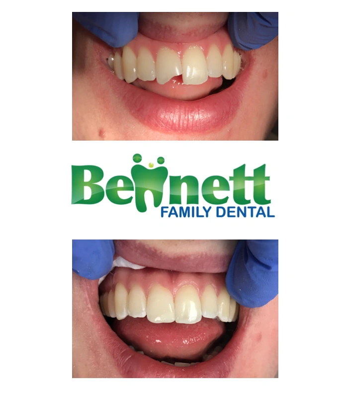Bennett Family Dental