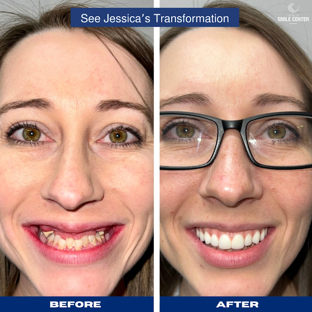Cleveland Smile Center