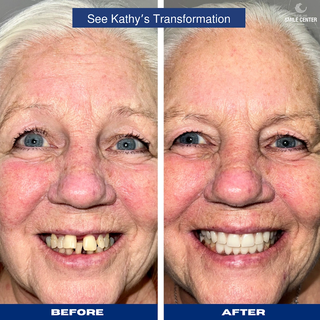 Cleveland Smile Center