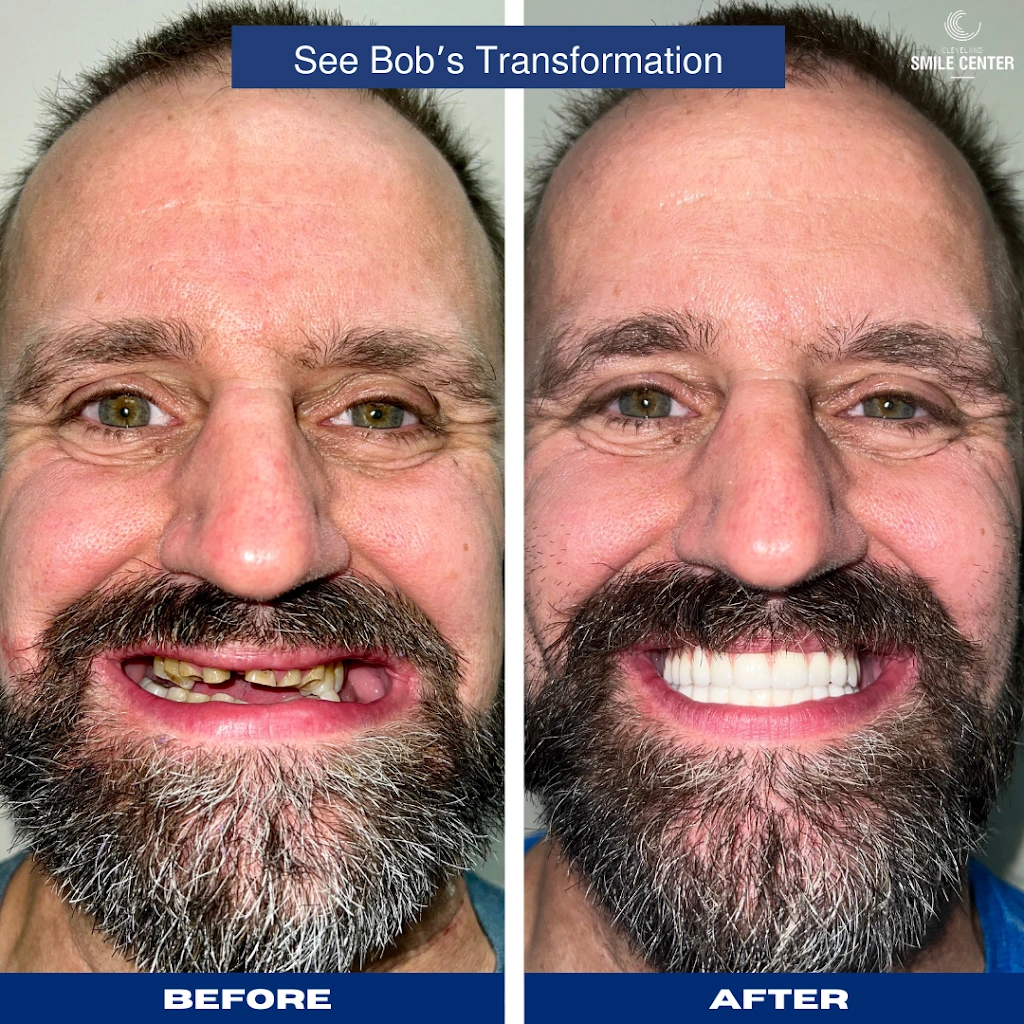 Cleveland Smile Center