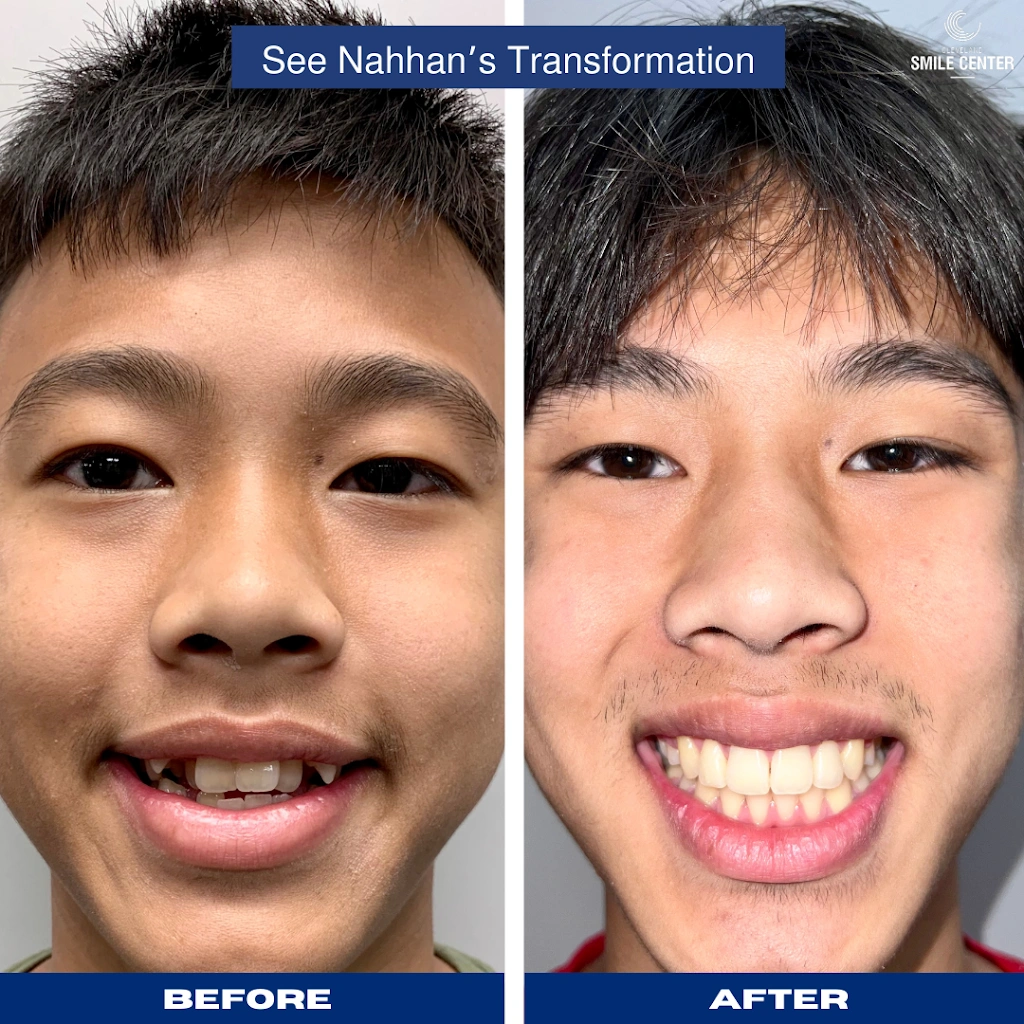 Cleveland Smile Center