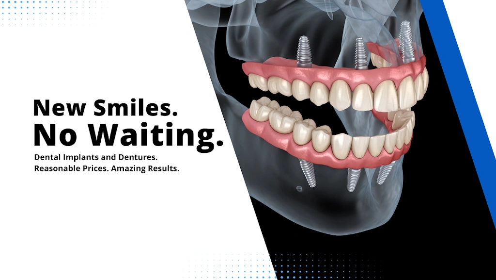 Cleveland Dentures and Implants