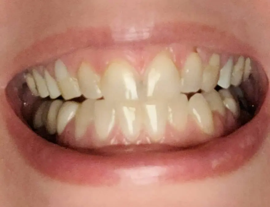 The Dental Studio of Avon Lake