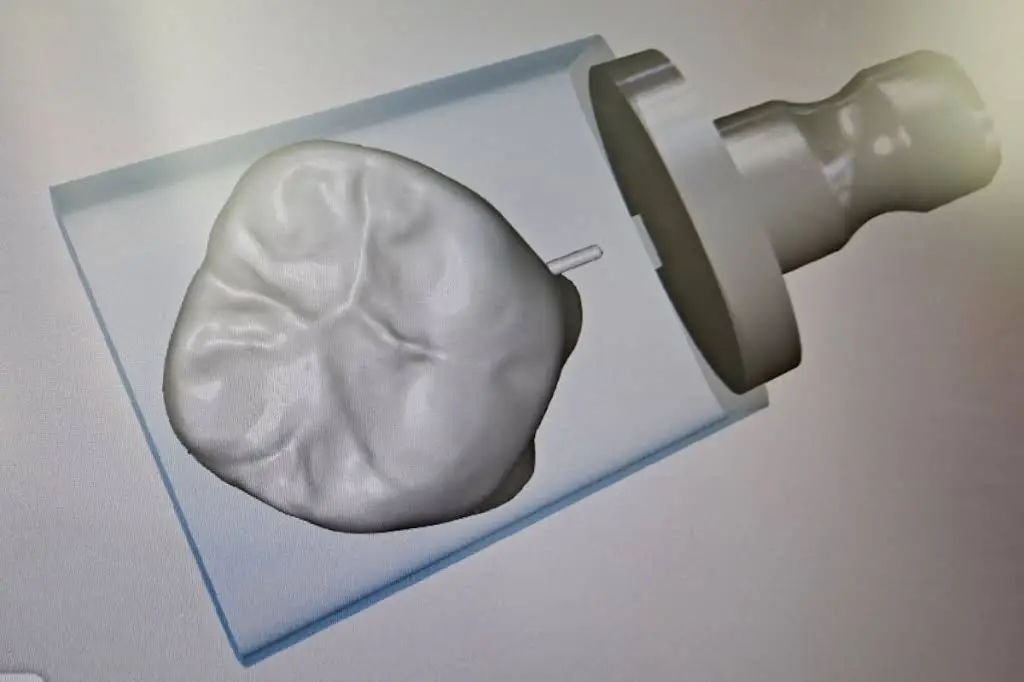 Raymond Dental Group