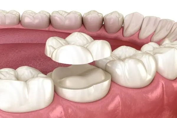 Mystic Pointe Dental