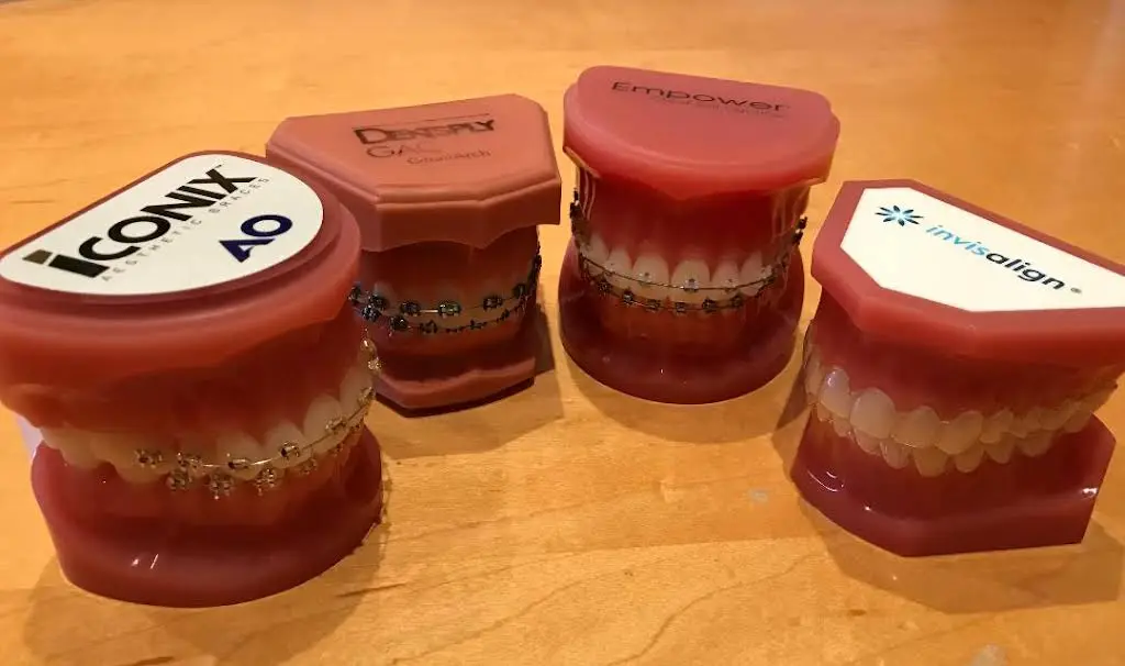 Braces in Markham
