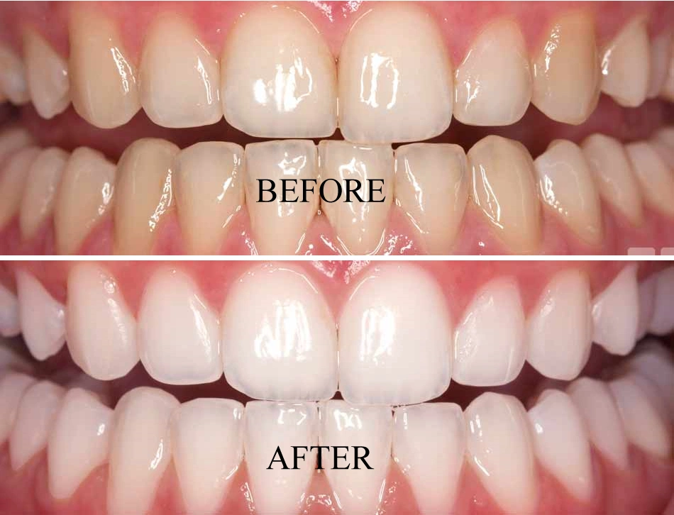The Tooth Corner Markham - Professional dental clinic exterior with modern facilities