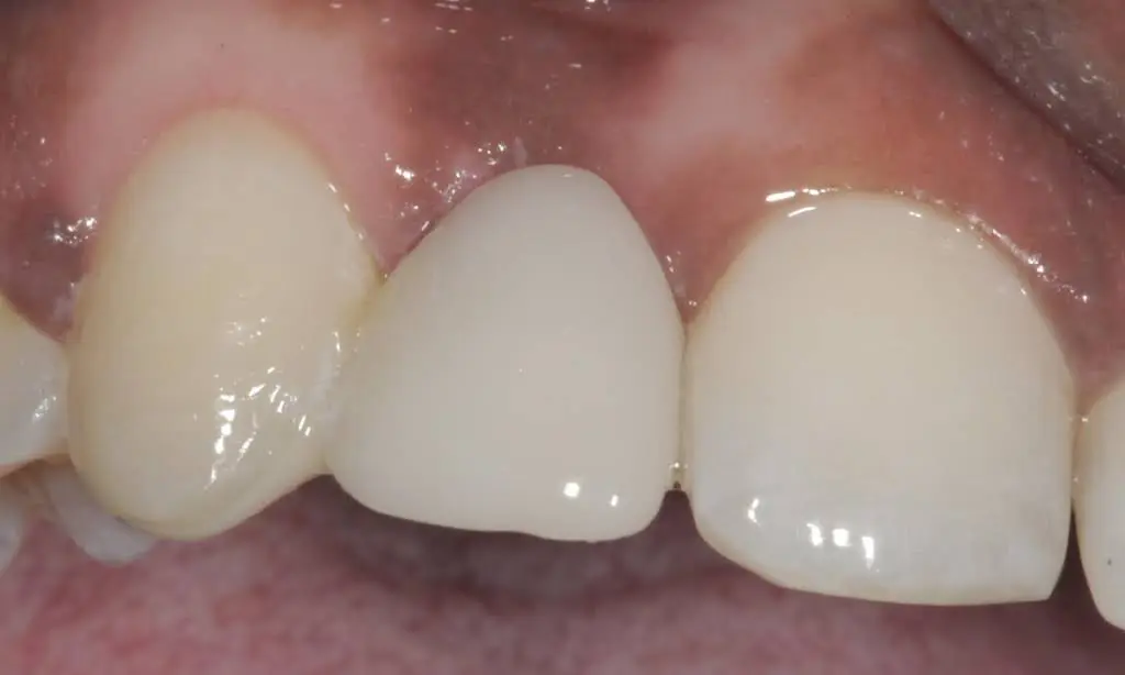The Tooth Corner Markham