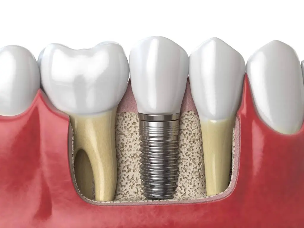 Smile Design Dental Studio